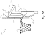 US 11,059,395 FIG. 3C, the invention's linkage system replacing the basketball hoop mount